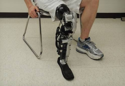 河南假肢:手術后什么時候安裝假肢好(圖1) 河南假肢:手術后什么時候安裝假肢好(圖1)