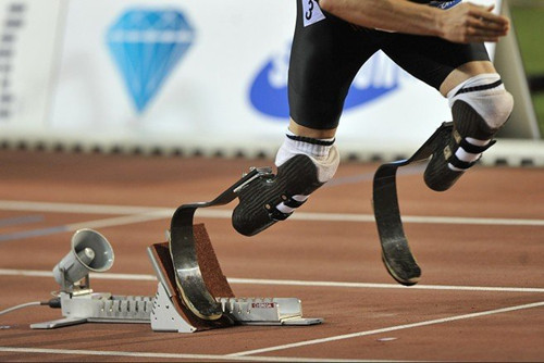 安裝假肢后走路出現(xiàn)步幅不均的原因有哪些(圖1) 安裝假肢后走路出現(xiàn)步幅不均的原因有哪些(圖1)