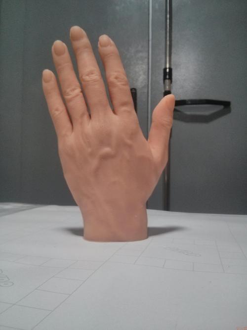 截肢后什么時(shí)間安裝假肢好怎么樣假肢發(fā)揮作用(圖1) 截肢后什么時(shí)間安裝假肢好怎么樣假肢發(fā)揮作用(圖1)